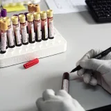 Why are cases of HIV infections on the rise among girls?