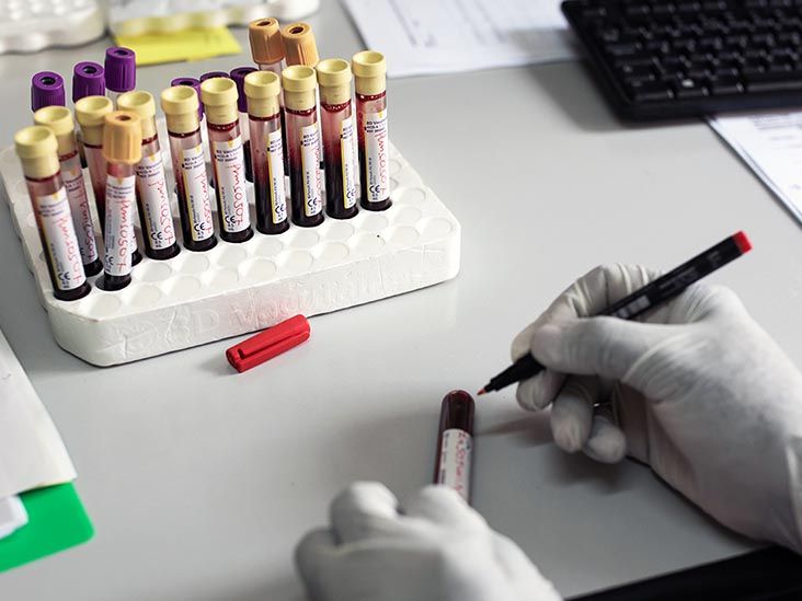 Why are cases of HIV infections on the rise among girls?