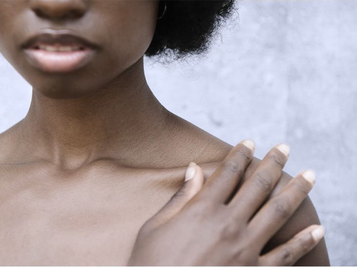 Vitamin B12 could boost tissue repair, help treat ulcerative colitis