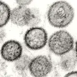 Julio Castro ve improbable un brote masivo de Hantavirus