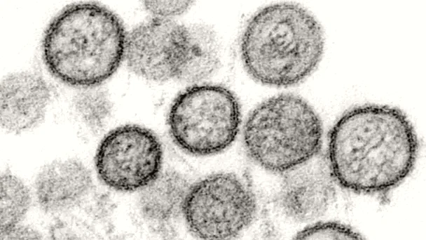 Julio Castro ve improbable un brote masivo de Hantavirus