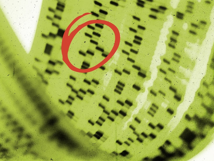 Could a new genetic therapy help reverse Alzheimer's?