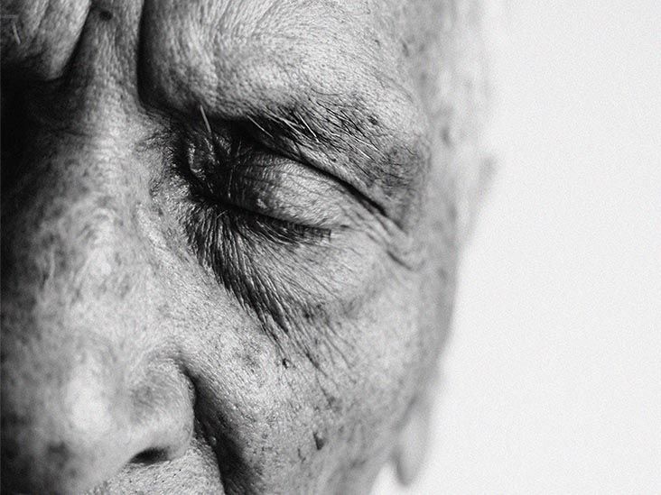 High levels of ‘good cholesterol’ may increase dementia risk