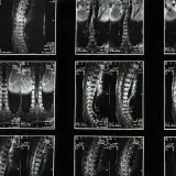 Comprehensive spinal x-ray images, ideal for medical studies and diagnostics.