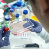 Stem cell therapy could protect cognition in progressive MS