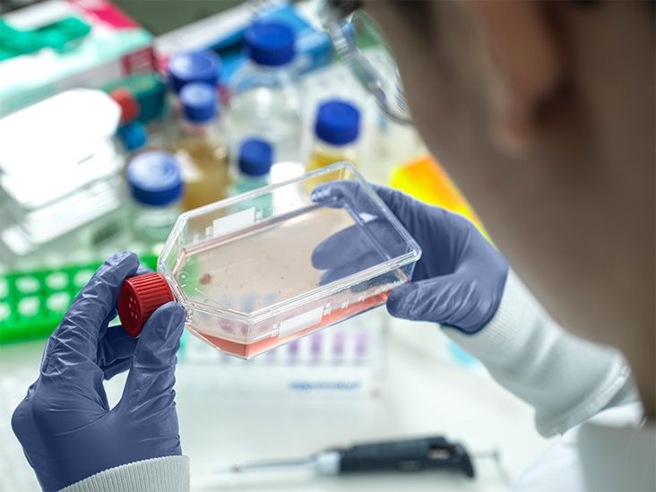 Stem cell therapy could protect cognition in progressive MS