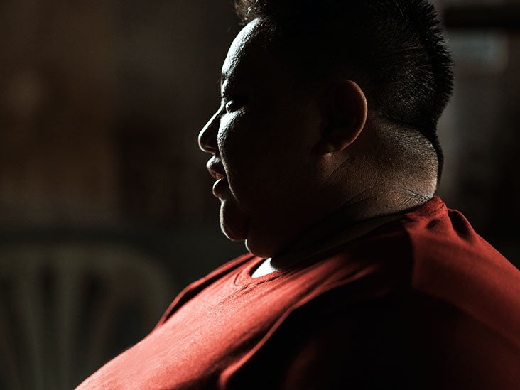 Why some experts think obesity may increase autoimmune risk