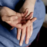 Eczema in babies: Scientists say skin biomarker may help predict atopic dermatitis