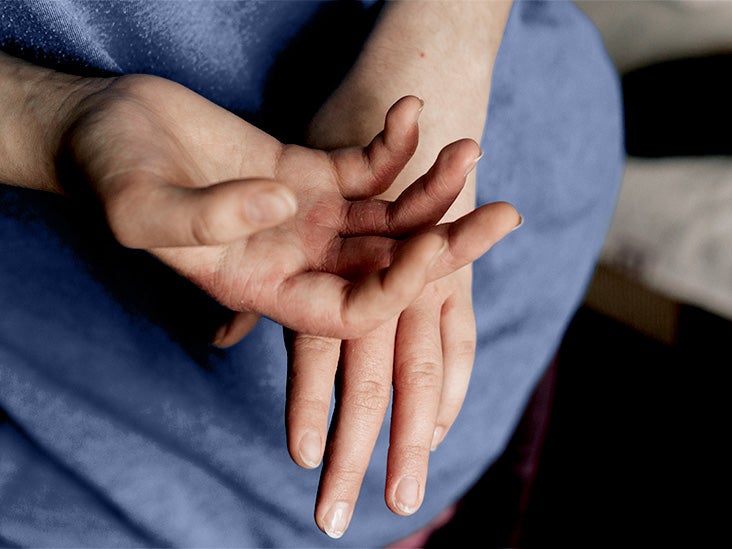 Eczema in babies: Scientists say skin biomarker may help predict atopic dermatitis