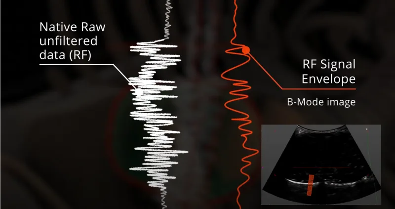 File:REMS Raw unfiltered signals.png