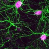 Una terapia experimental logra frenar el alzhéimer inicial