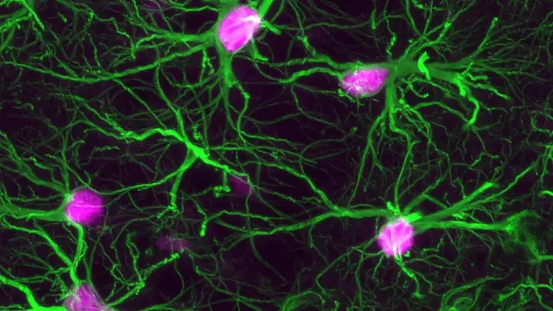 Una terapia experimental logra frenar el alzhéimer inicial