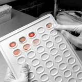 New blood test shows promise in detecting 18 types of cancer