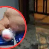 
			Delincuente venezolano pierde una mano al explotar una dinamita en extorsión		