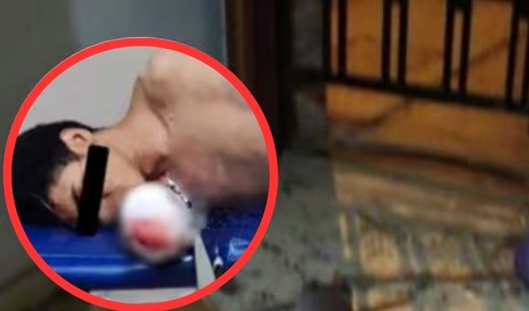 
			Delincuente venezolano pierde una mano al explotar una dinamita en extorsión		