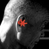Earbud-like wearable tech could help identify Alzheimer's and Parkinson's