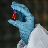 Experimental blood test may detect Parkinson’s before symptom onset