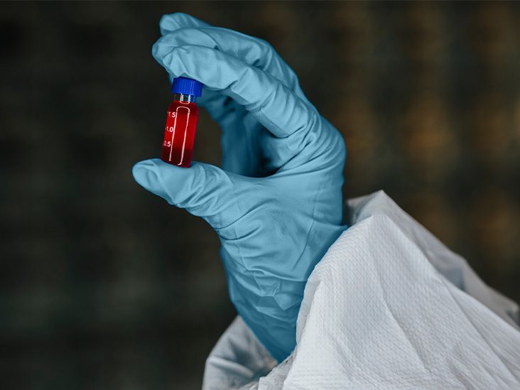 Experimental blood test may detect Parkinson’s before symptom onset