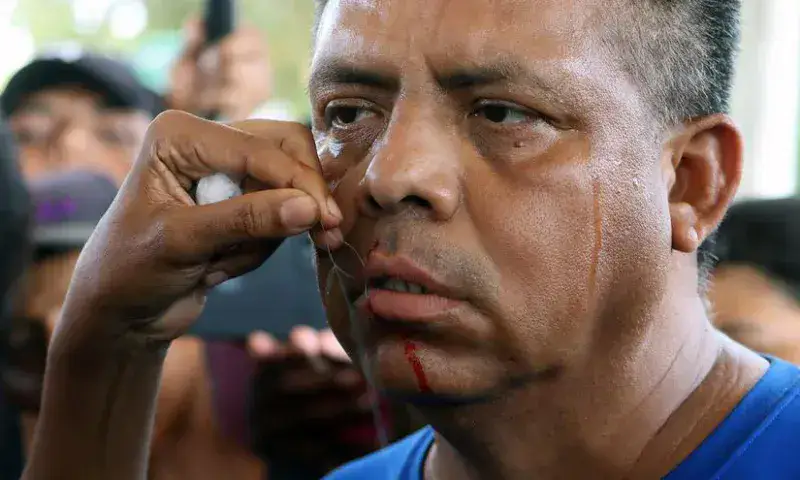 Migrantes se cosen labios para presionar a Migración de México