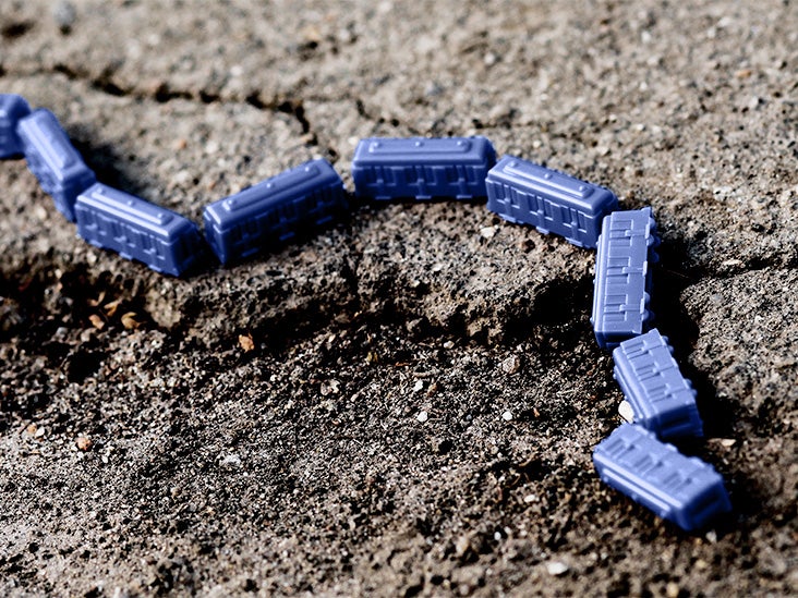 Schizophrenia: Researchers say network disruptions in the brain may be a factor
