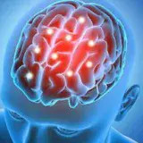 Medicamento experimental contra el Alzhéimer arroja resultados prometedores