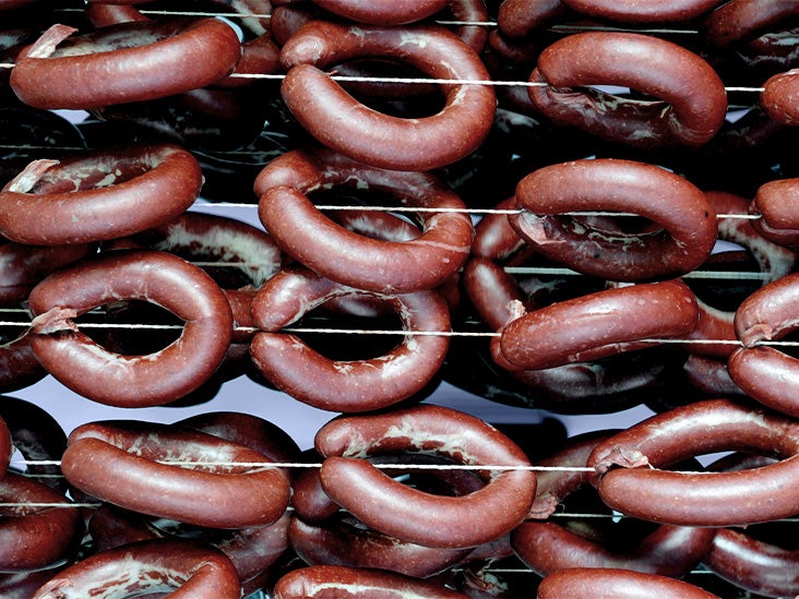 Red meat and refined carbs linked to 70% of type 2 diabetes cases globally