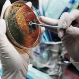 Toxin from gut bacteria may trigger multiple sclerosis onset and relapse
