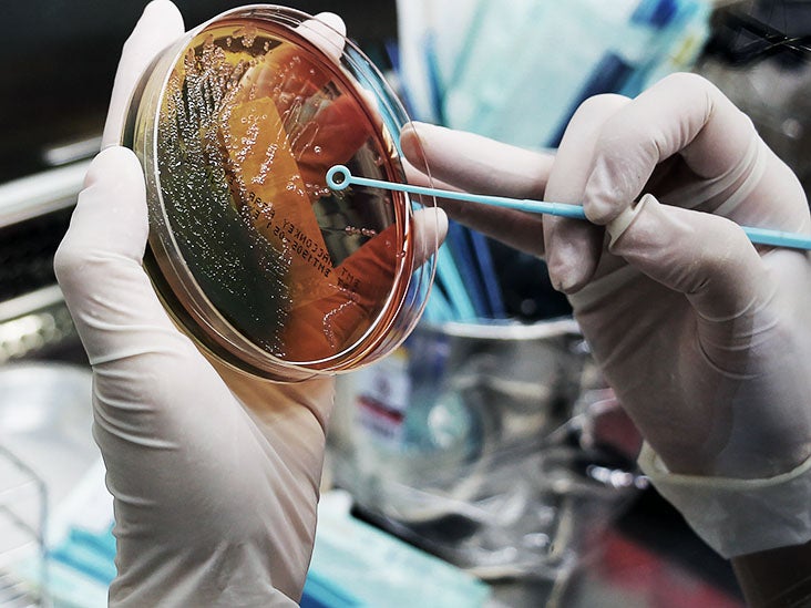 Toxin from gut bacteria may trigger multiple sclerosis onset and relapse