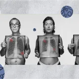 Not just a smokers' disease: Breaking the lung cancer stigma