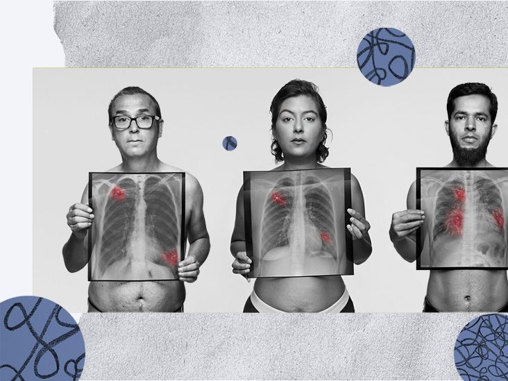 Not just a smokers' disease: Breaking the lung cancer stigma