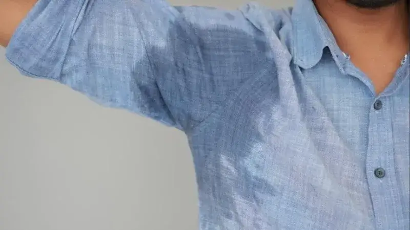 La hiperhidrosis podría originarse en los nervios