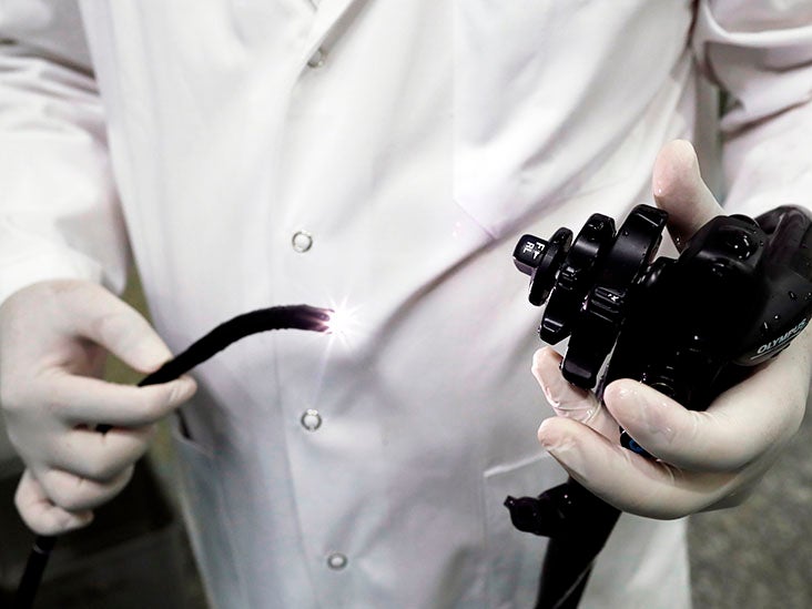 One-hour endoscopic procedure could eliminate the need for insulin for type 2 diabetes