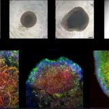 
			Construye un ordenador funcional con tejido cerebral humano		