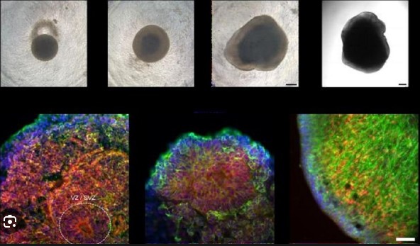 Construye un ordenador funcional con tejido cerebral humano