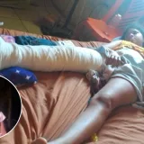 A adolescente le urge una cirugía por fractura de fémur 
