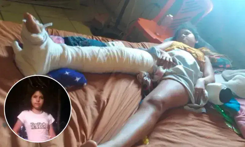 A adolescente le urge una cirugía por fractura de fémur 