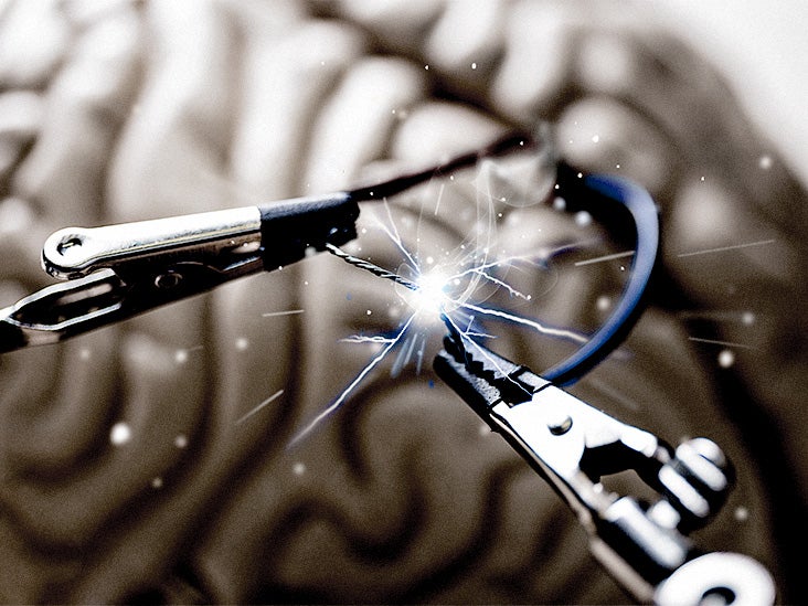 Alzheimer's: Alternative treatment could target 2 pairing proteins driving disease