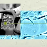 Stem cells may help identify new schizophrenia drugs