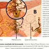 La melanina explica por qué unos se broncean y otros no