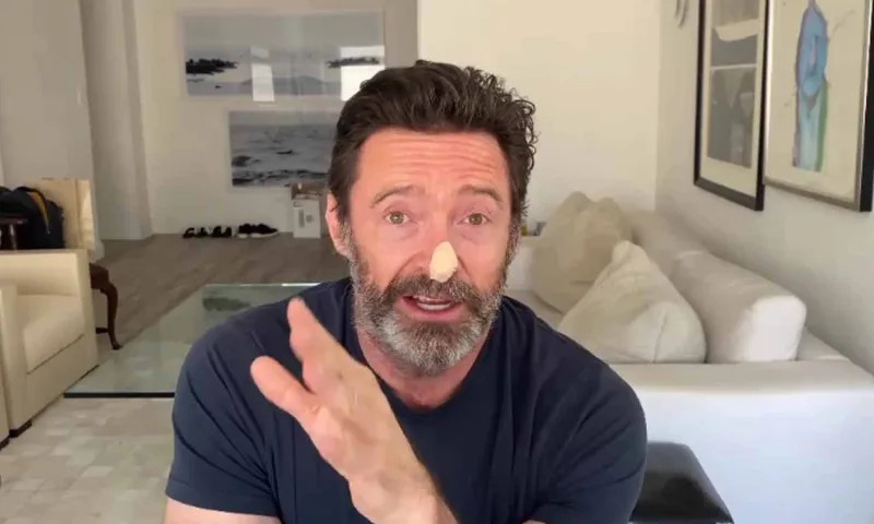 Hugh Jackman se somete a dos nuevas biopsias ante el riesgo de cáncer