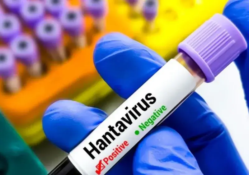 Especialistas aclaran que el hantavirus no pasa entre personas