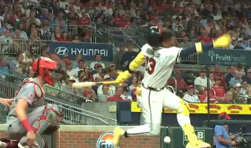 Ronald Acuña Jr. esquiva la fractura tras recibir fuerte golpe