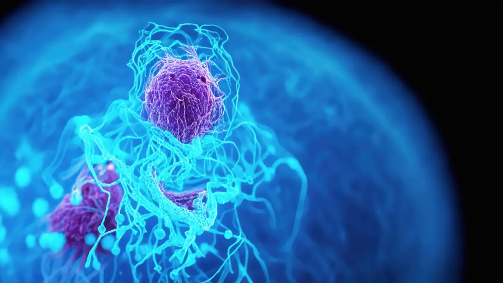 Identifican una estrategia que ataca células del cáncer de páncreas y activa defensas