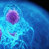 Identifican una estrategia que ataca células del cáncer de páncreas y activa defensas