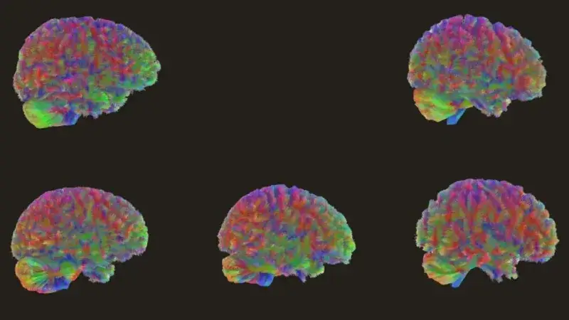 Así madura el cerebro adolescente y por qué cambia por fases