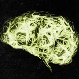 People with schizophrenia may have abnormal cyclic gene activity in their brain