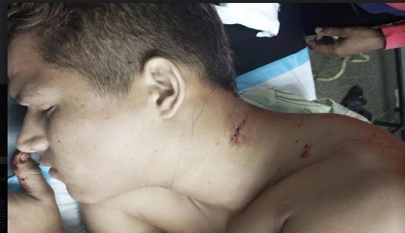 Casi pierde la vida el boxeador Jonkeiber Molina en Bachaquero al recibir una puñalada en el cuello