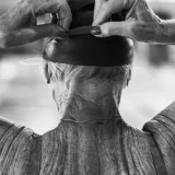 Healthy microbiome plays a role in skin aging, researchers say